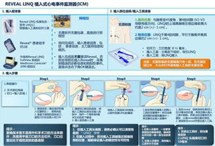 植入式心電事件監測器的臨床應用推廣——以北京市衛生科技成果推廣項目為例